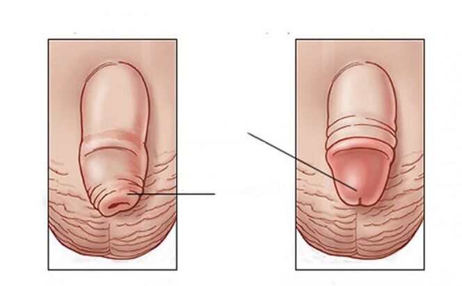 ¿Qué tarea hace un lubricante