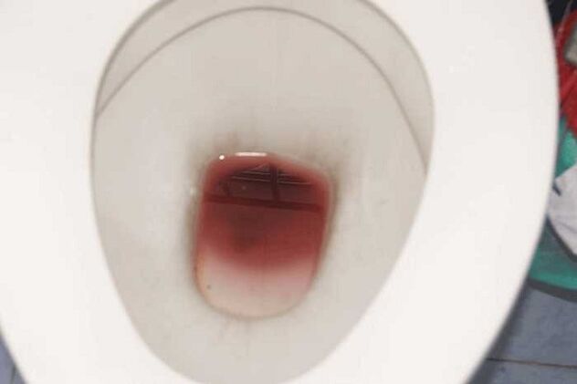 manchas en los hombres cuando están emocionados